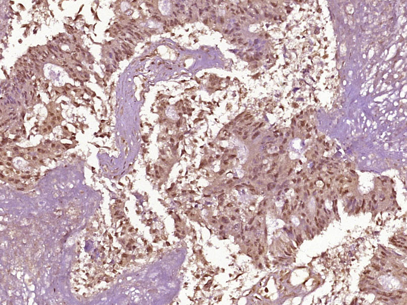 Rabbit anti-Phospho-NFKB p65(Thr254) Polyclonal Antibody