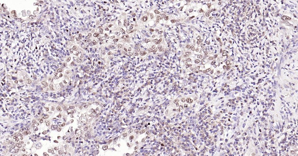 Rabbit anti-Phospho-Nrf2(Ser40) Monoclonal Antibody