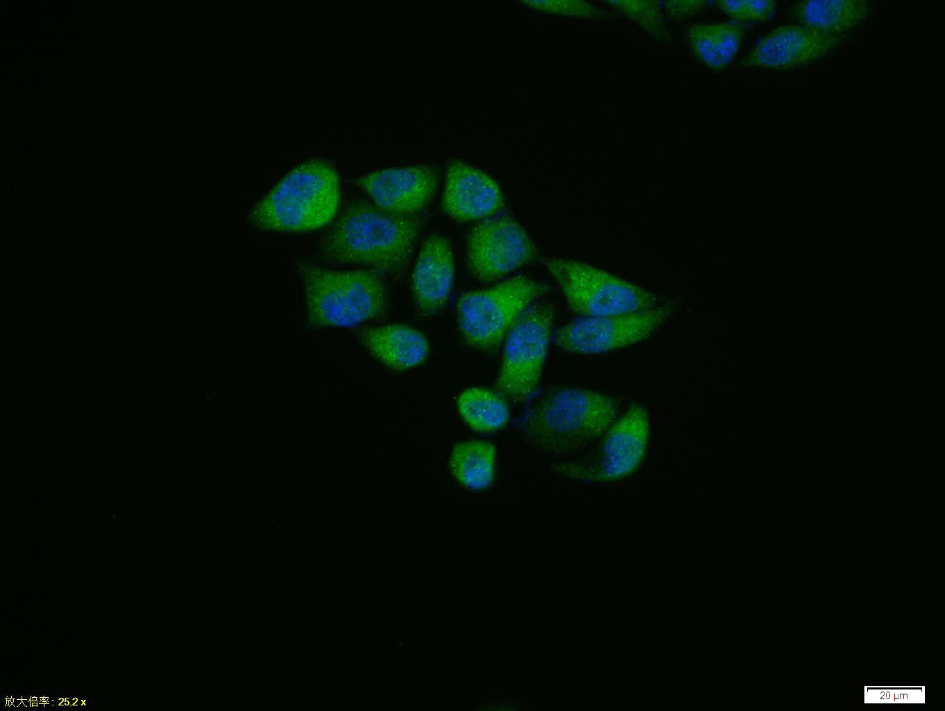 Rabbit anti-Phospho-HSP27(Ser15) Polyclonal Antibody