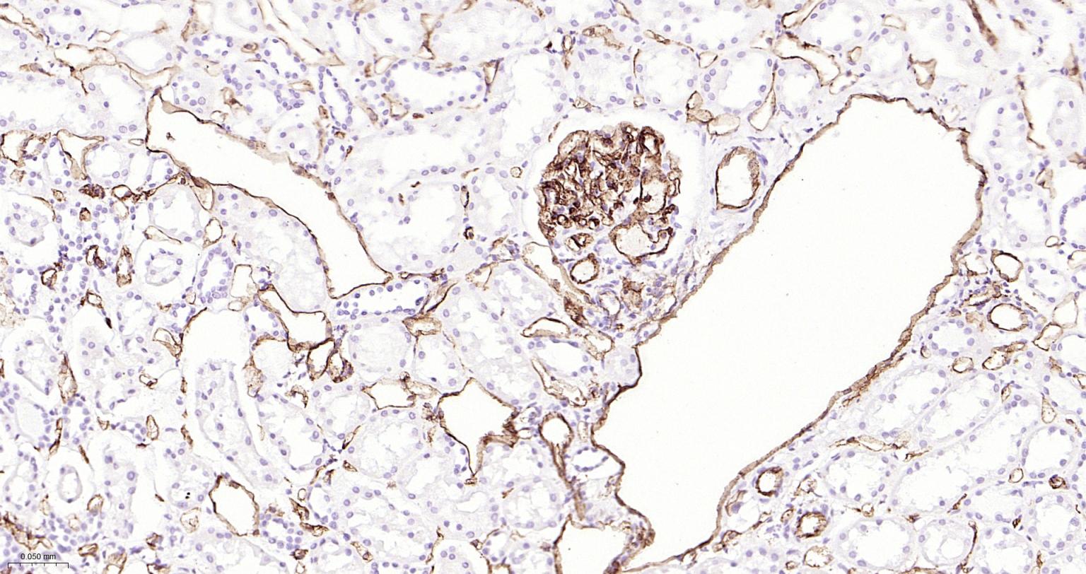 Mouse anti-CD31 Monoclonal Antibody