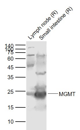 Rabbit anti-MGMT Polyclonal Antibody