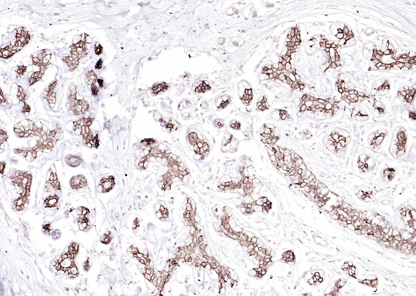 Mouse anti-Cytokeratin 8 Monoclonal Antibody