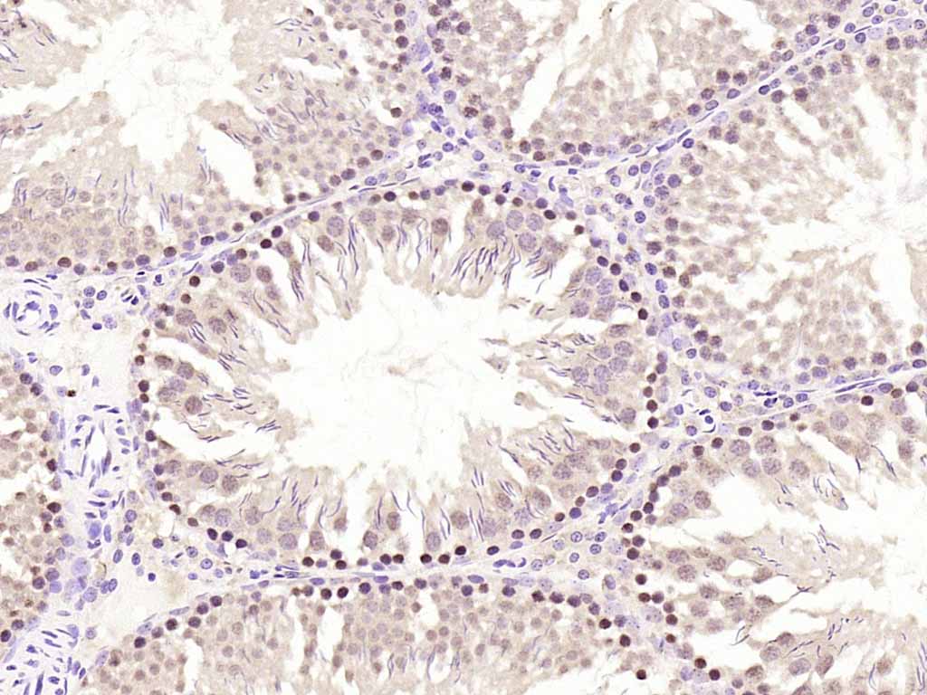Rabbit anti-Phospho-PKC δ(Ser645) Polyclonal Antibody