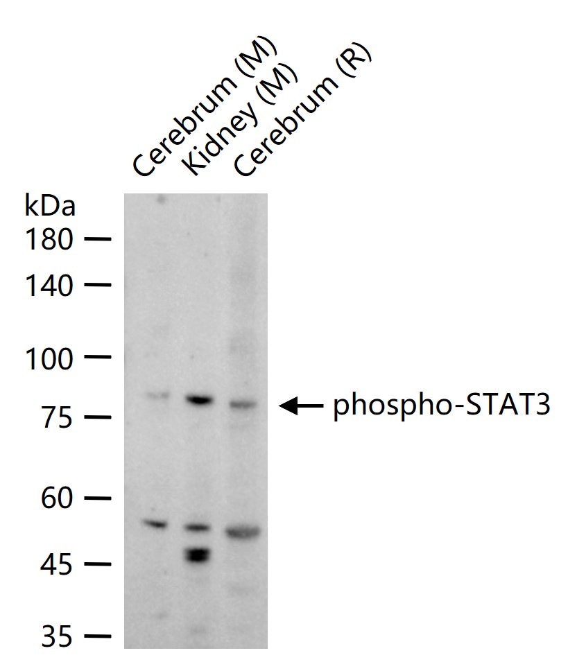 Rabbit anti-Phospho-STAT3(Tyr705) Polyclonal Antibody