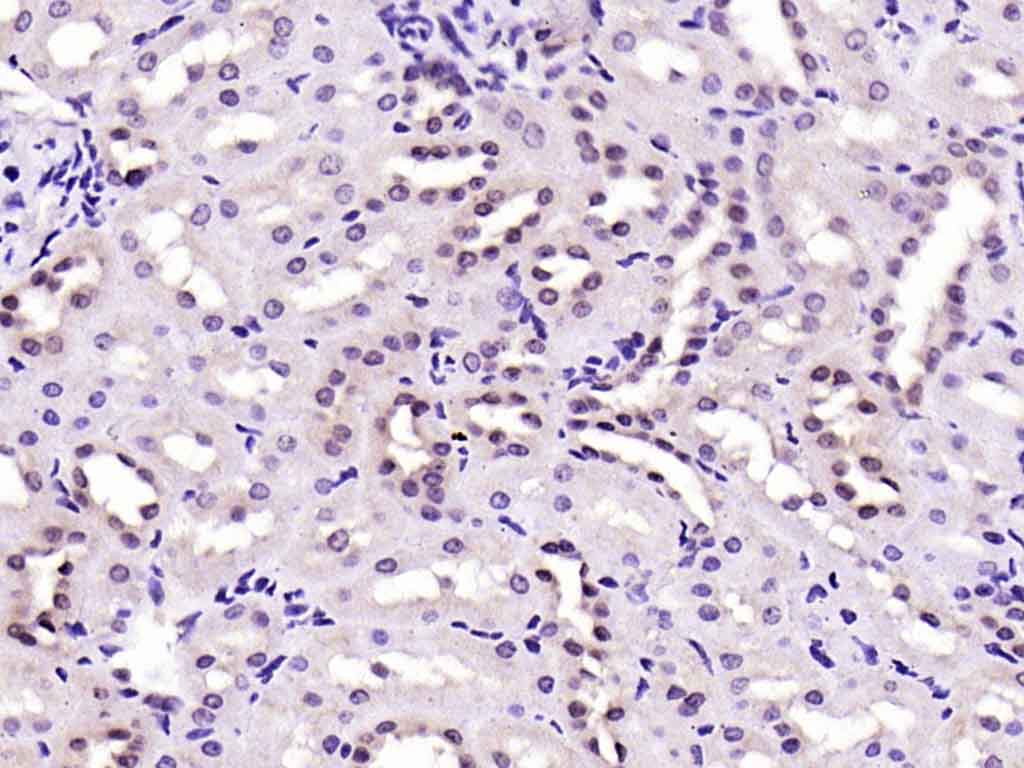 Rabbit anti-Phospho-FAK(Tyr576+Tyr577) Polyclonal Antibody
