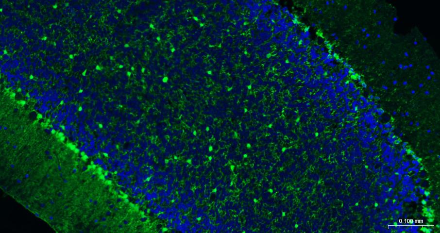 Mouse anti-S100B Monoclonal Antibody