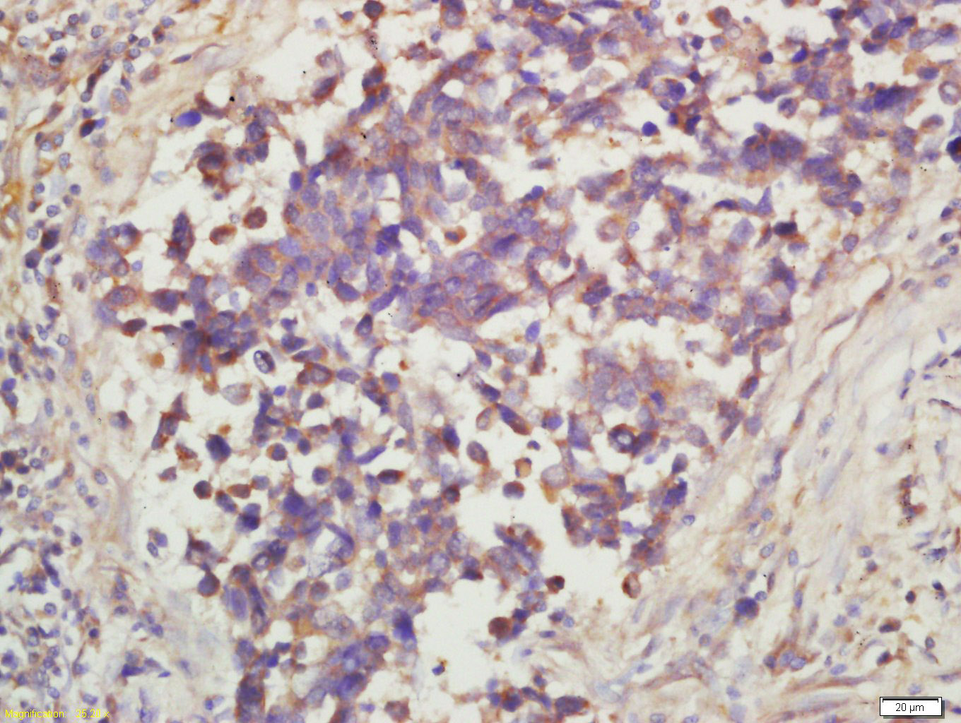 Rabbit anti-Phospho-mTOR(Ser2448) Polyclonal Antibody