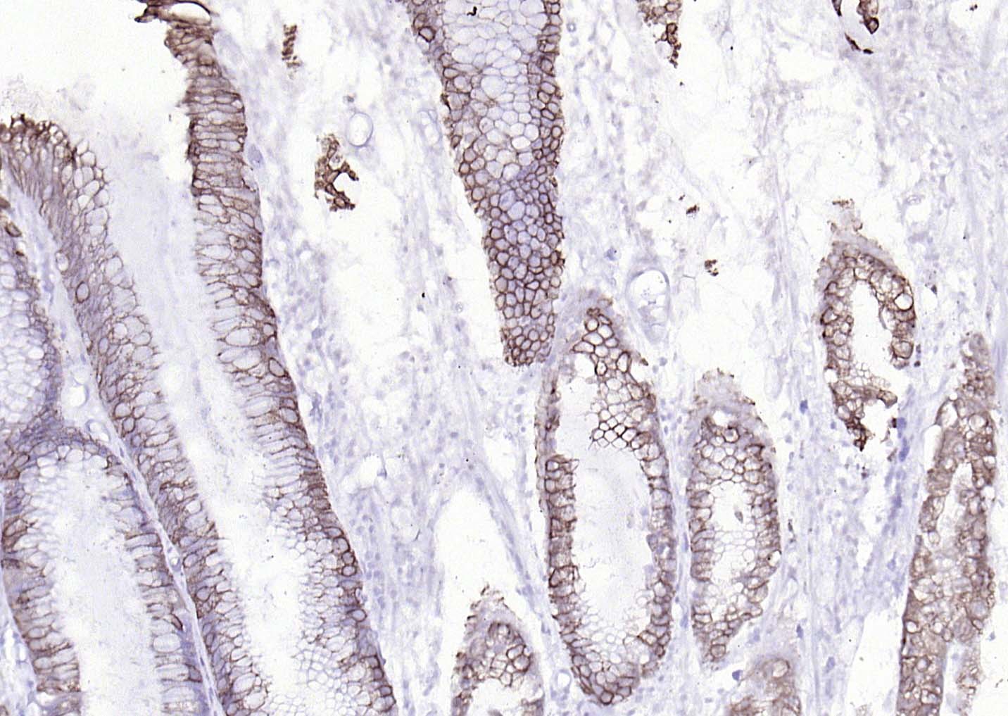 Mouse anti-Cytokeratin 8 Monoclonal Antibody
