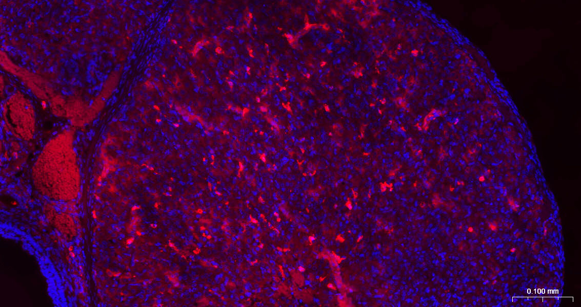 Rabbit anti-Galectin 3 Polyclonal Antibody