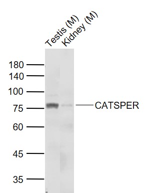 Rabbit anti-CATSPER Polyclonal Antibody