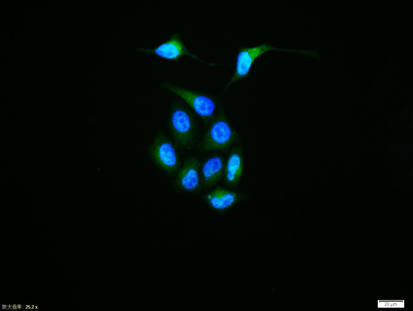 Rabbit anti-Phospho-EGFR(Tyr1068) Polyclonal Antibody