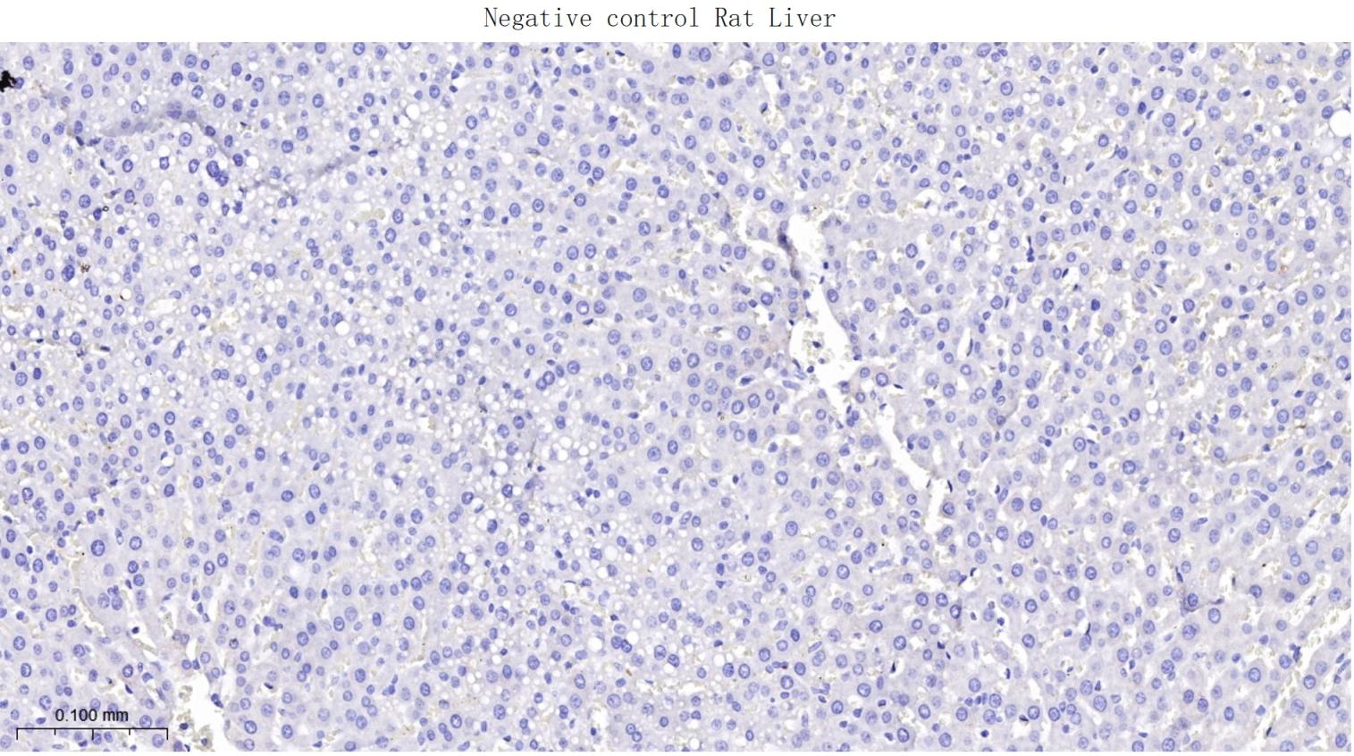 Rabbit anti-RAGE Monoclonal Antibody