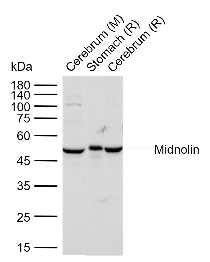 Rabbit Anti-Midnolin Polyclonal Antibody