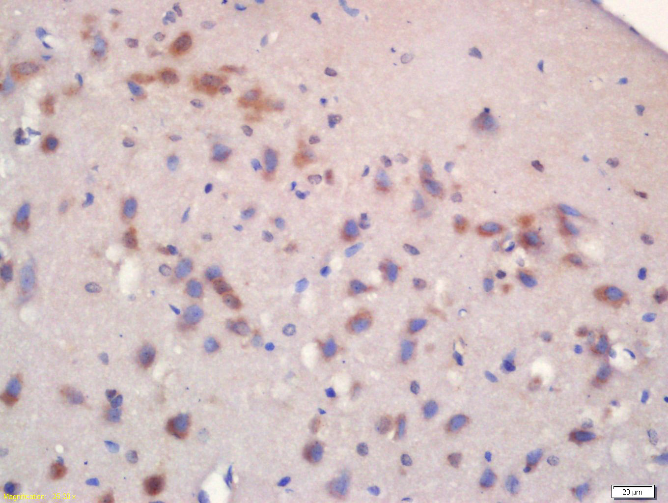 Rabbit anti-Phospho-mTOR(Ser2481) Polyclonal Antibody