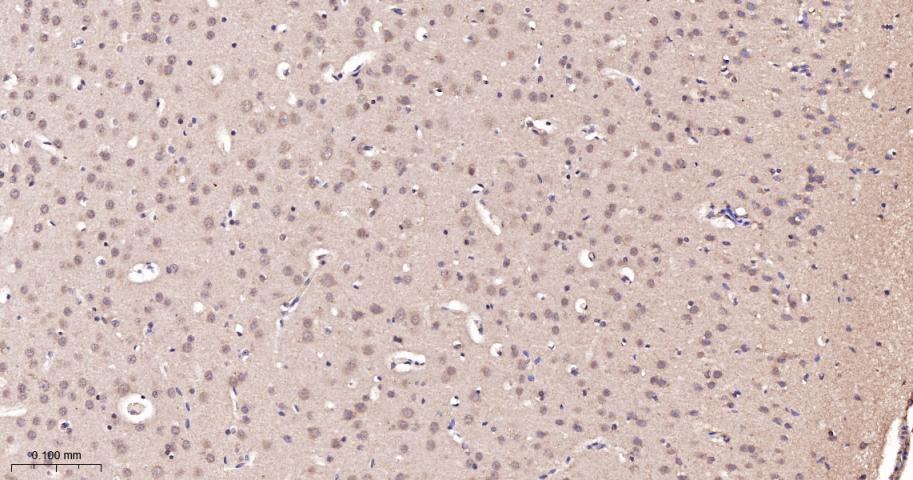 Rabbit anti-TSG101 Monoclonal Antibody