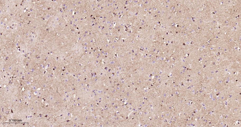 Mouse anti-S100B Monoclonal Antibody