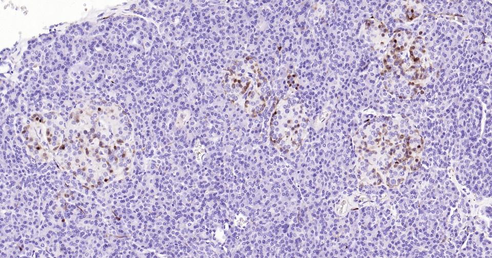 Mouse anti-S100B Monoclonal Antibody