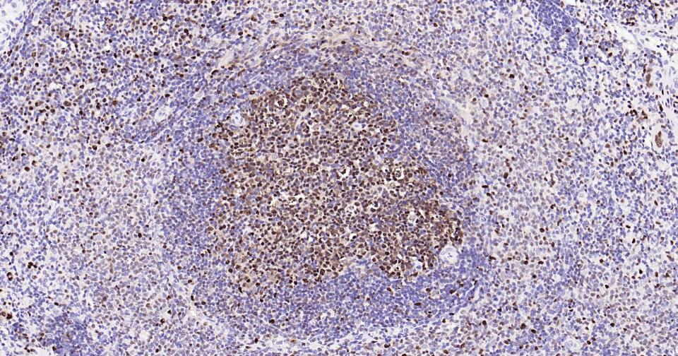 Rabbit anti-PCNA(Nuclear Loading Control) Monoclonal Antibody