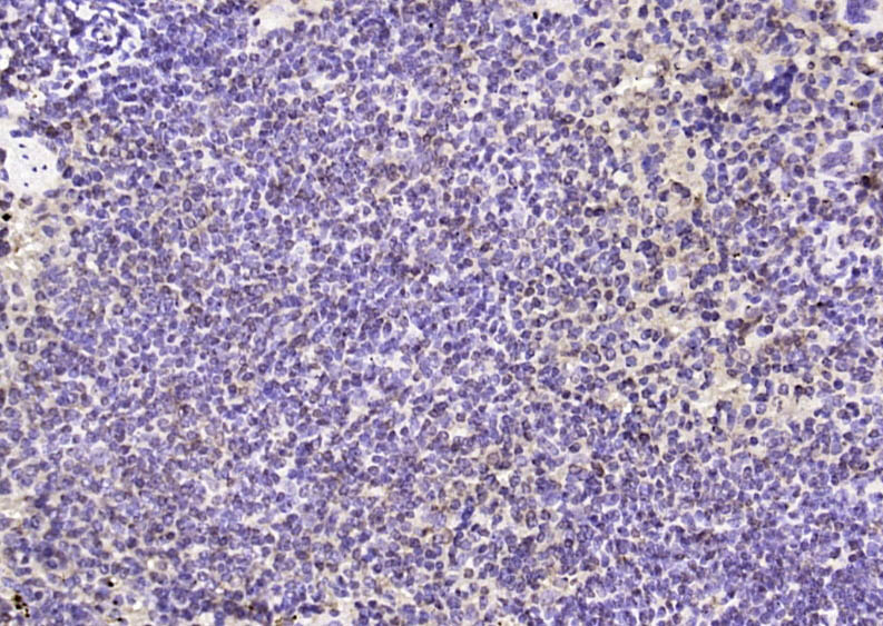 Rabbit anti-Phospho-FAK(Ser722) Polyclonal Antibody