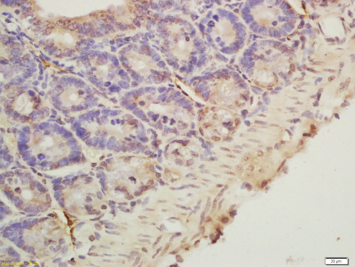 Rabbit anti-Phospho-CDKN1B(Ser178) Polyclonal Antibody
