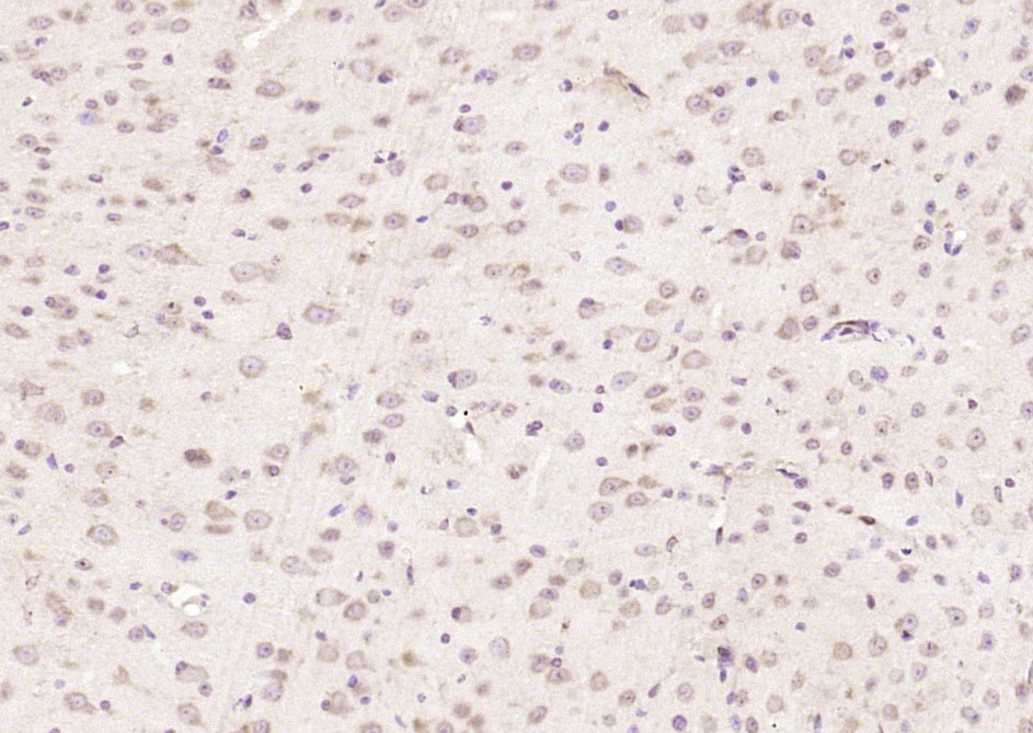 Rabbit Anti-STK3+STK4 Polyclonal Antibody