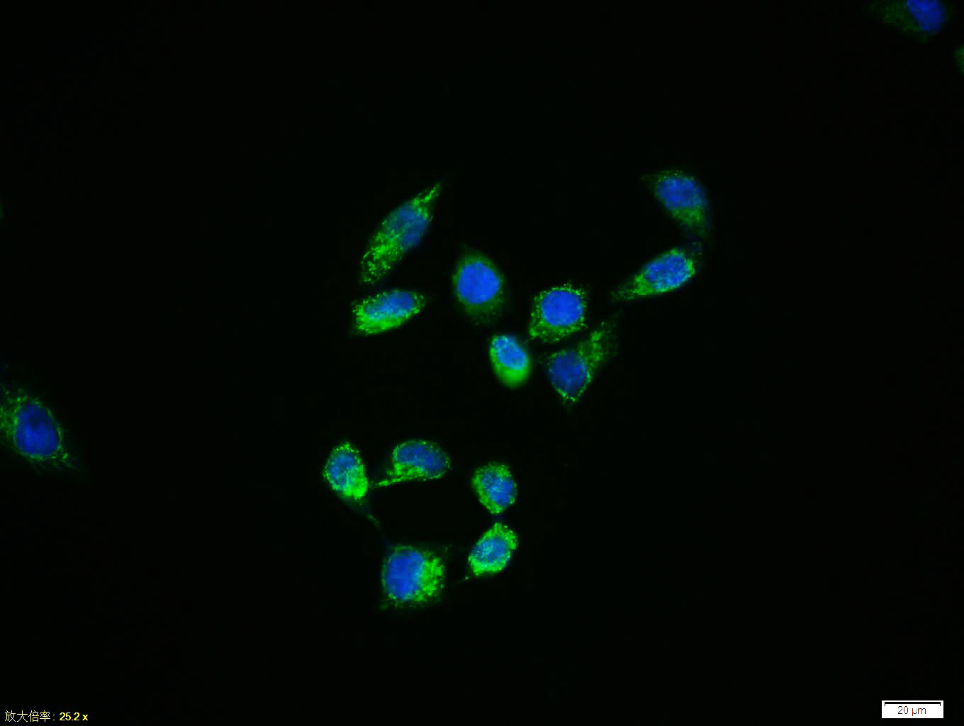 Rabbit anti-Phospho-HSP27(Ser78) Polyclonal Antibody