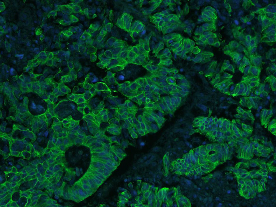 Mouse anti-Cytokeratin 8 Monoclonal Antibody