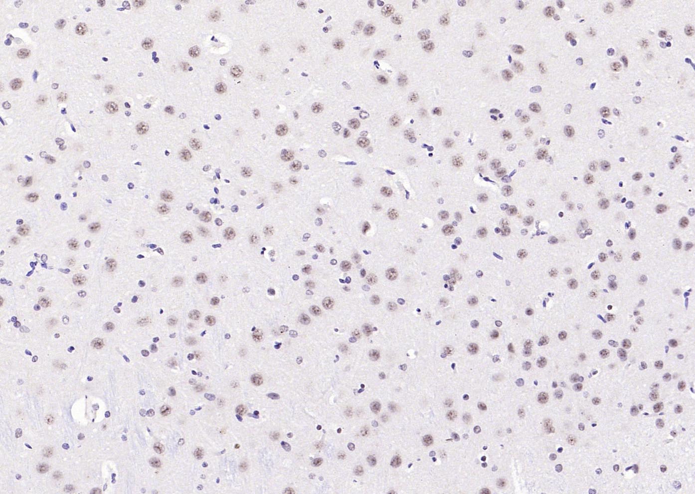 Rabbit anti-Phospho-PI3 Kinase p110 β(Ser1070) Polyclonal Antibody
