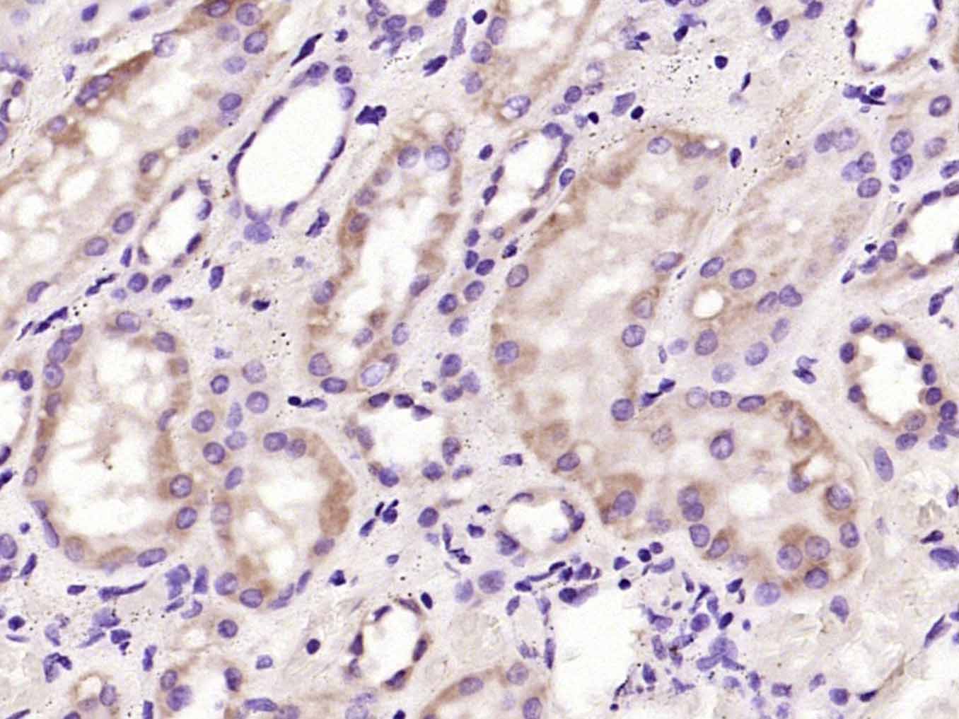 Mouse anti-VEGF Monoclonal Antibody