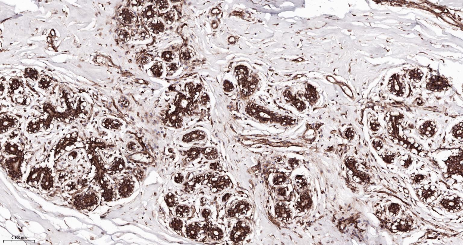 Rabbit anti-NFKB p65 Monoclonal Antibody
