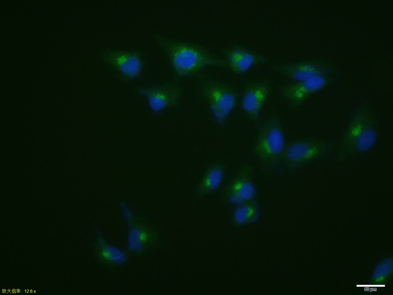 Rabbit anti-Phospho-P53(Ser46) Polyclonal Antibody