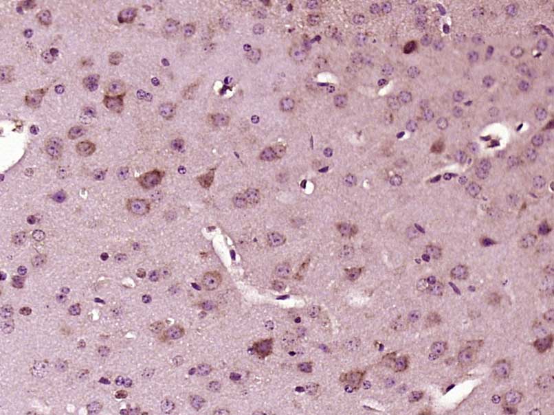 Rabbit anti-Phospho-IRS1(Tyr1179) Polyclonal Antibody