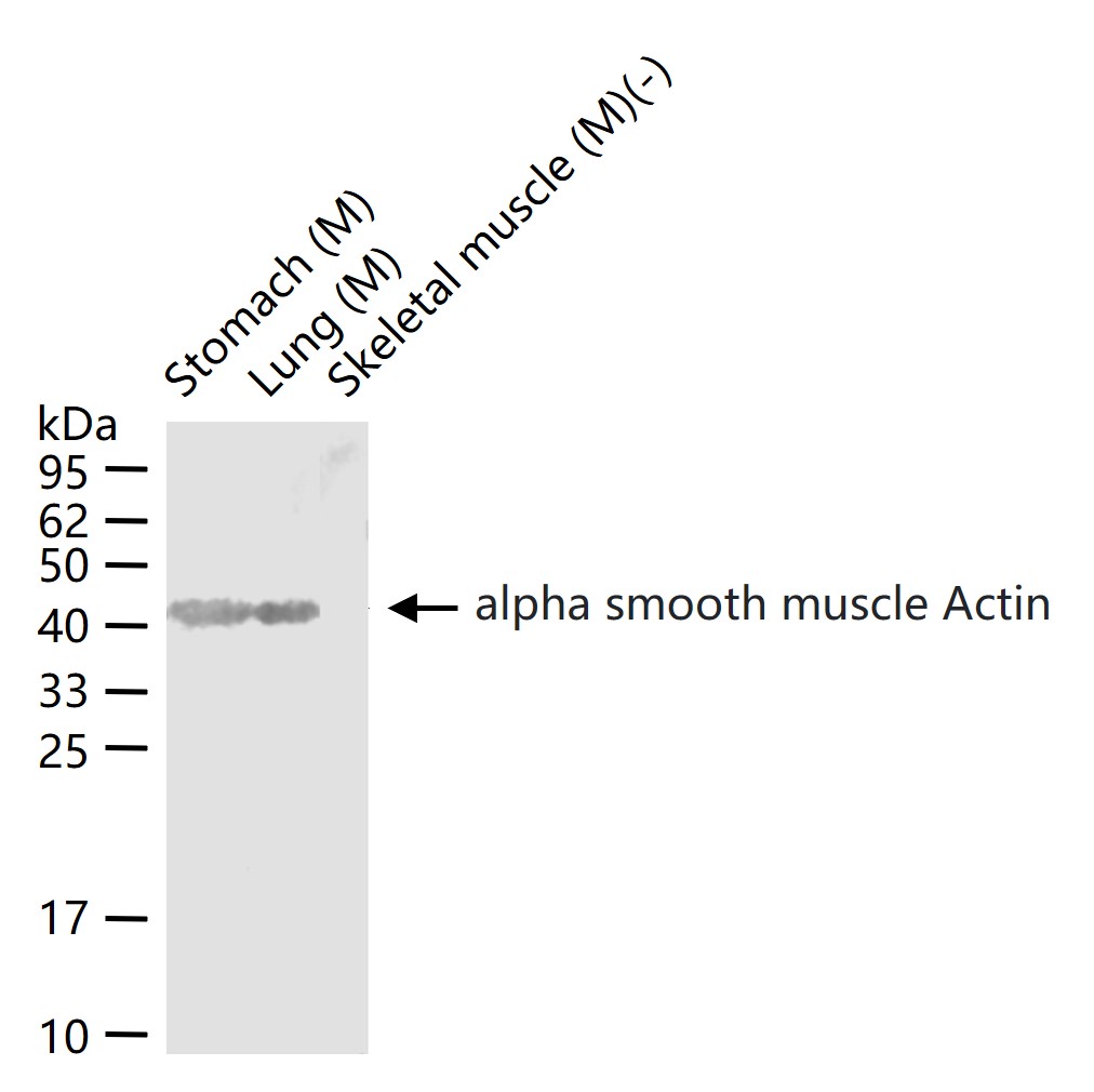 Rabbit anti-α Smooth Muscle Actin Polyclonal Antibody
