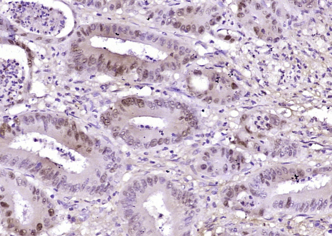 Rabbit anti-Phospho-β-Catenin(Ser33+Ser37) Polyclonal Antibody