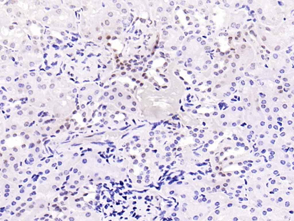 Rabbit anti-Phospho-Smad2(Ser467) Polyclonal Antibody