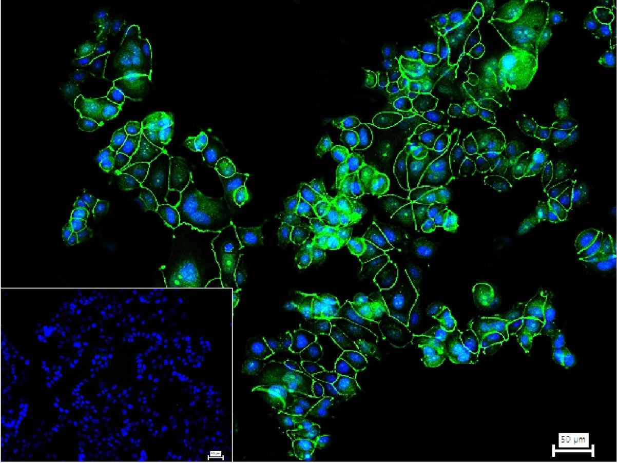 Rabbit anti-ZO-1 Polyclonal Antibody