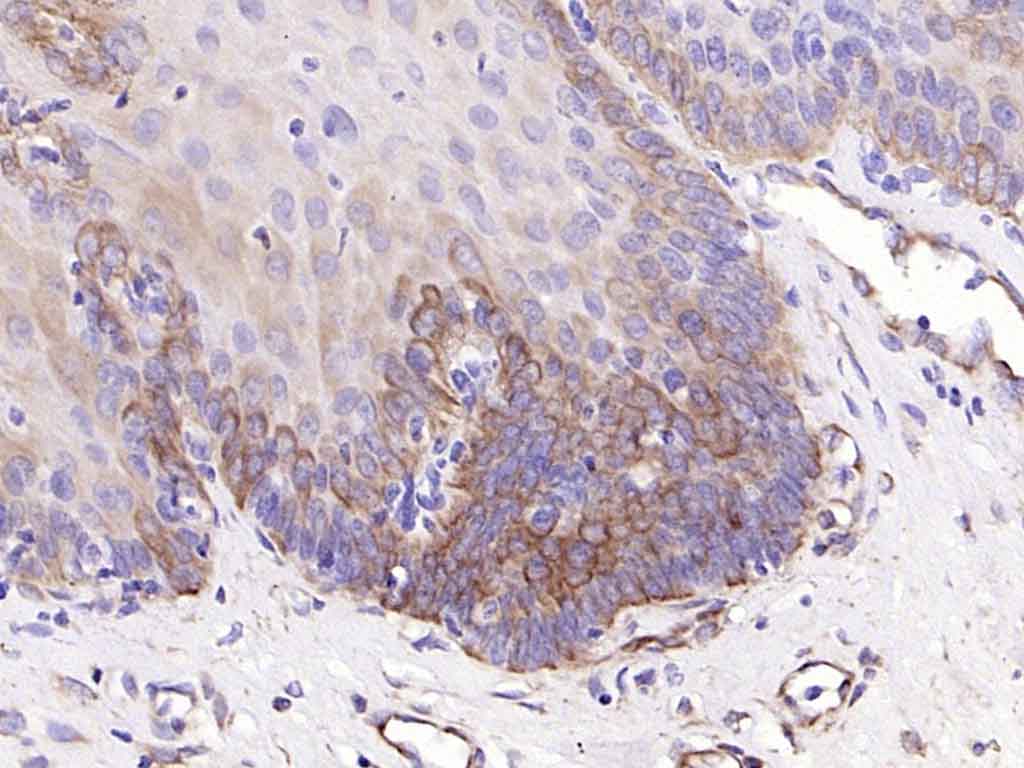 Mouse anti-Cytokeratin 19 Monoclonal Antibody