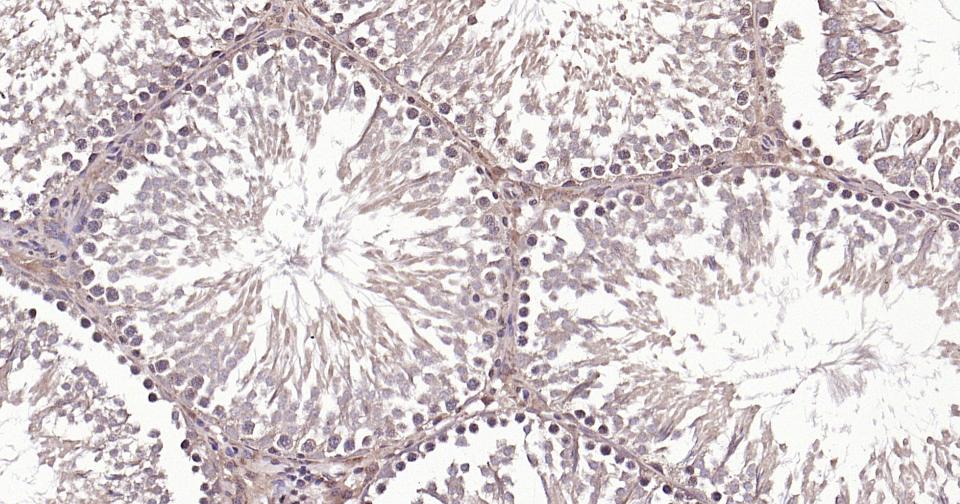 Rabbit anti-β-Tubulin Polyclonal Antibody