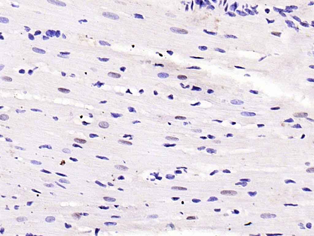 Rabbit anti-Phospho-Smad2(Ser467) Polyclonal Antibody