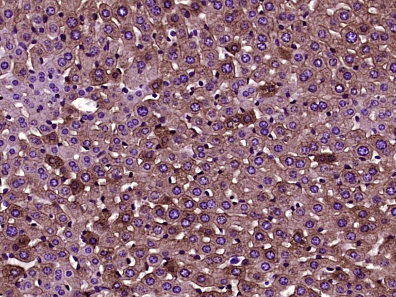 Mouse anti-Cytokeratin 8 Monoclonal Antibody