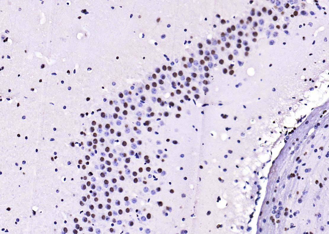 Rabbit anti-Phospho-PTEN(Ser380+Thr382+Thr383) Polyclonal Antibody