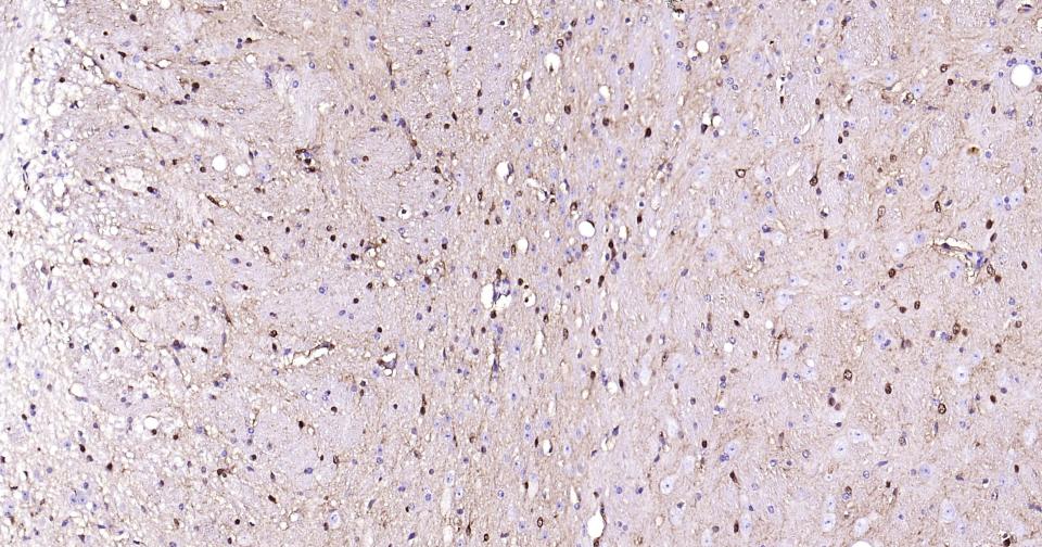 Mouse anti-S100B Monoclonal Antibody
