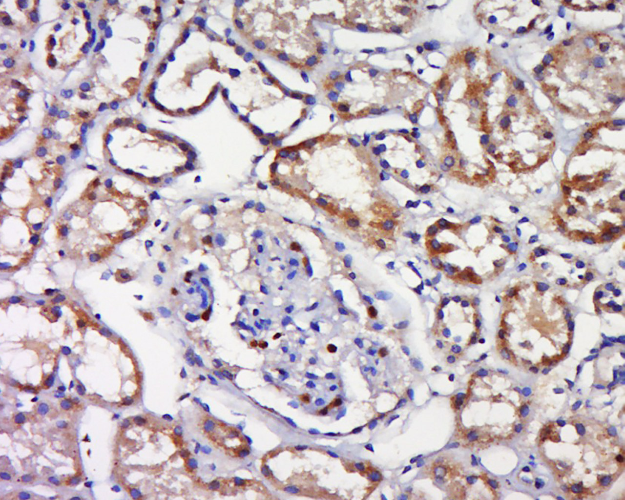 Rabbit anti-Phospho-TAK1(Ser192) Polyclonal Antibody