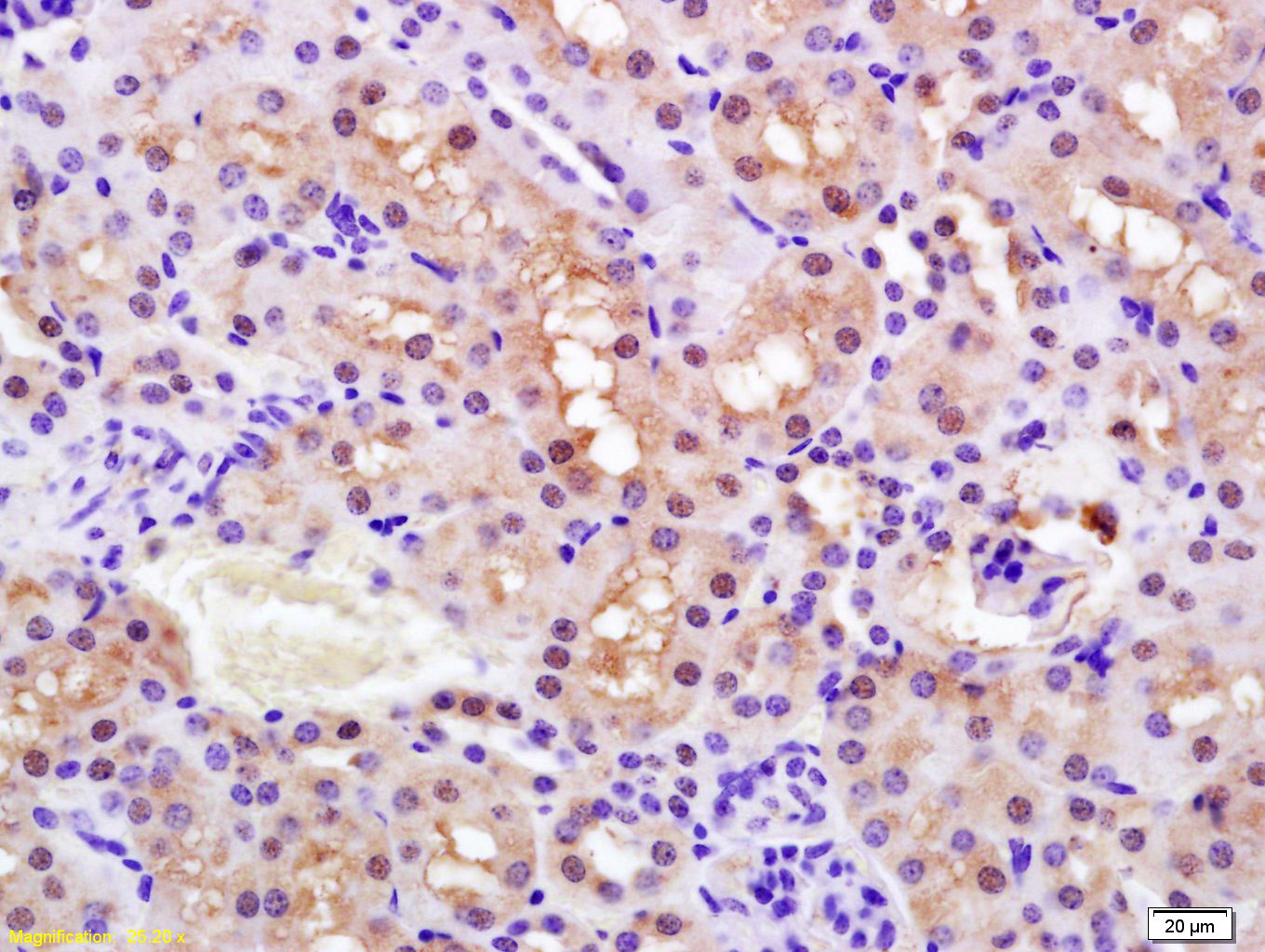 Rabbit anti-Phospho-PPARα(Ser12) Polyclonal Antibody