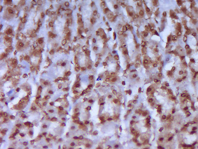 Rabbit anti-Phospho-CK18(Ser52) Polyclonal Antibody