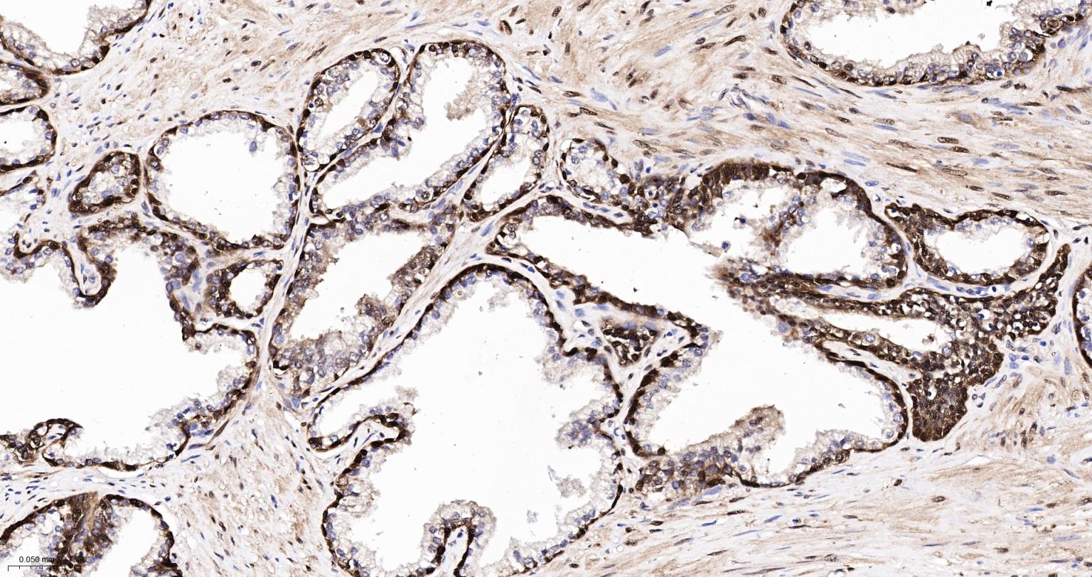 Rabbit anti-HSP70 Monoclonal Antibody