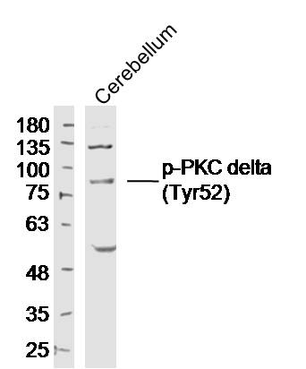 Rabbit anti-Phospho-PKC δ(Tyr52) Polyclonal Antibody