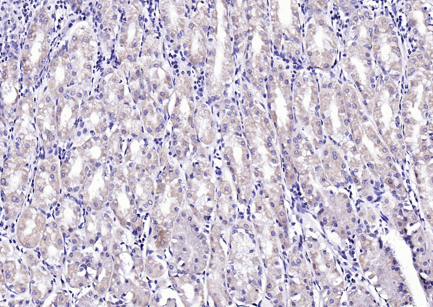 Rabbit anti-Phospho-CaMK2α(Tyr230) Polyclonal Antibody