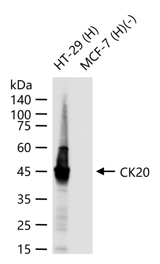 Rabbit anti-CK20 Monoclonal Antibody