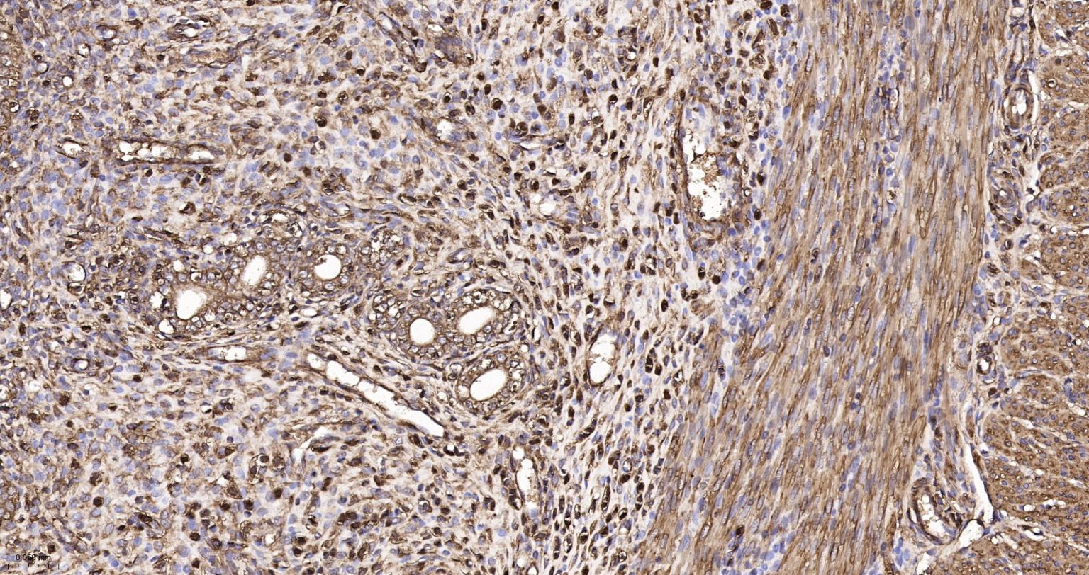 Rabbit anti-α Smooth Muscle Actin Polyclonal Antibody